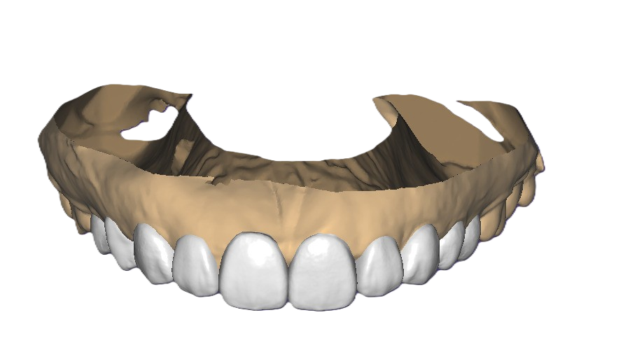 Digital Dental Design